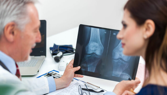 8 warning signs of low bone density