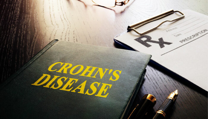 Top 10 early warning signs of Crohn’s