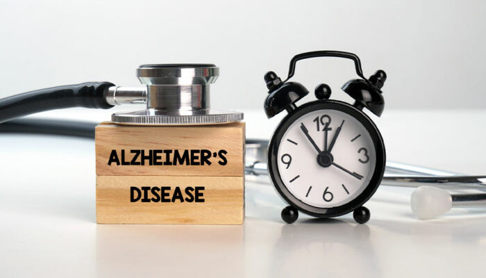 Alzheimer’s disease – 7 tips to manage the condition