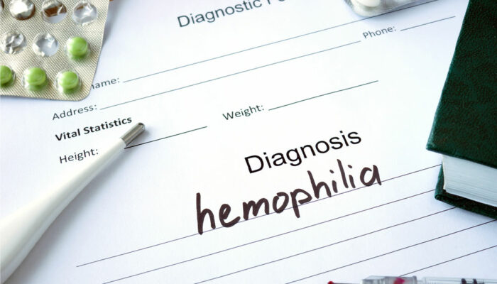 Hemophilia – Its types, symptoms, and management