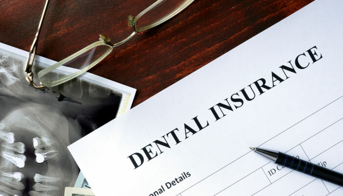 7 mistakes to avoid when choosing a dental plan